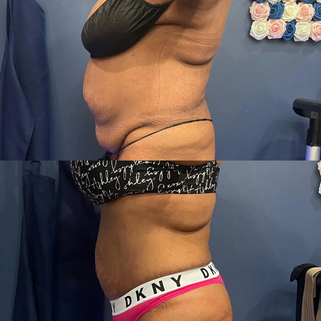 Dream Body Bundle